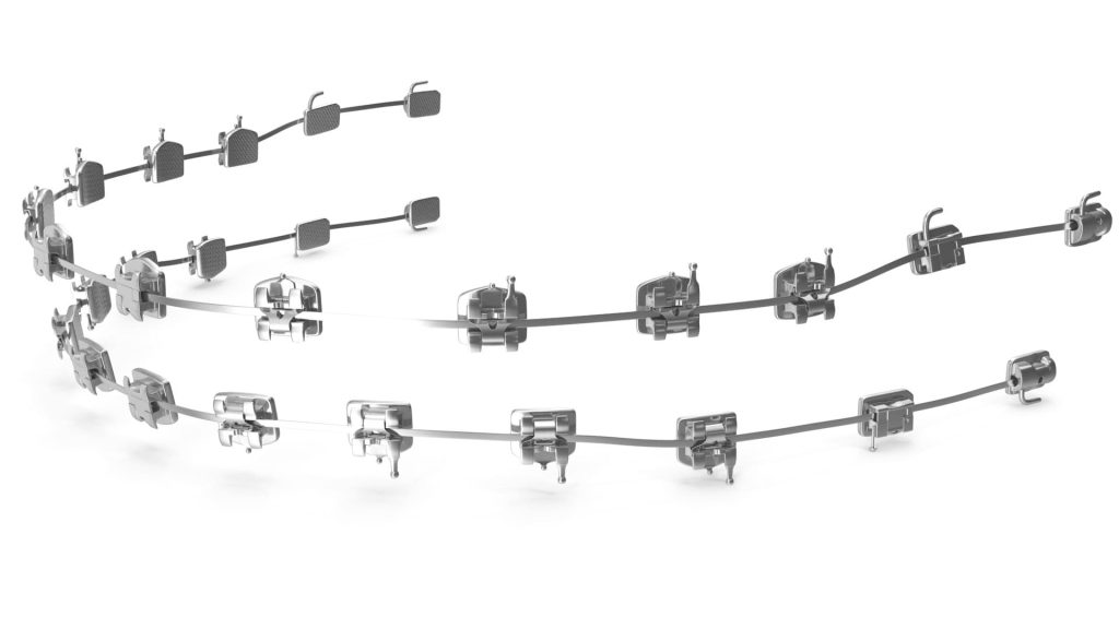 Aparelho Autoligado 6 autoligado