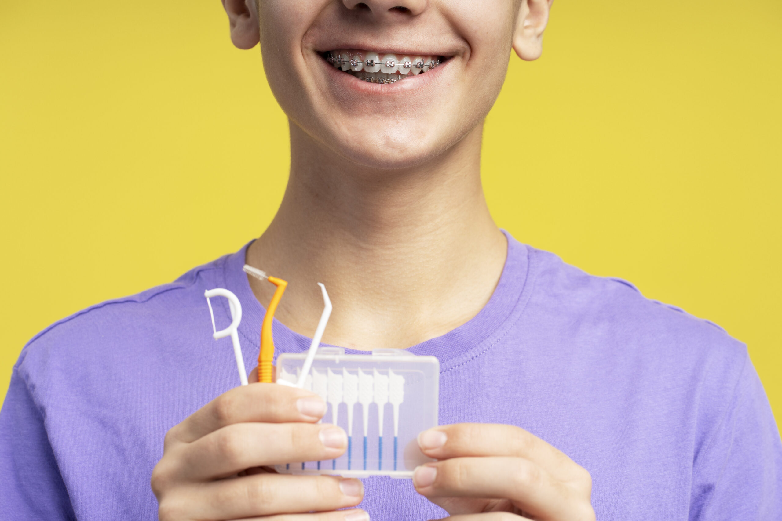 Como passar fio dental com aparelho ortodôntico.